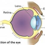 Progressive Retinal Atrophy 